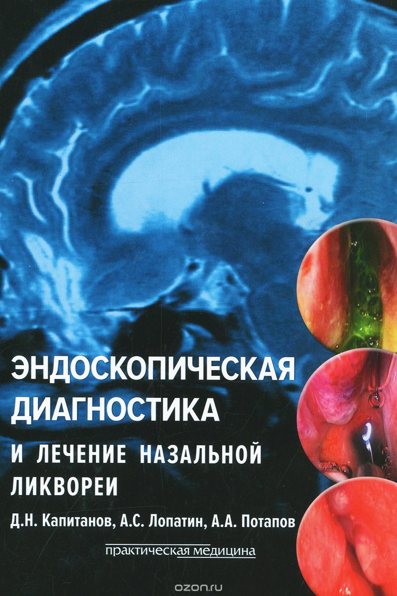 Скачать книгу "Эндоскопическая диагностика и лечение назальной ликвореи, Д. Н. Капитанов, А. С. Лопатин, А. А. Потапов"
