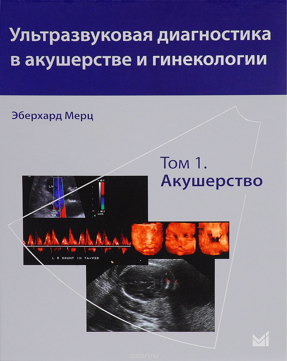 Скачать книгу "Ультразвуковая диагностика в акушерстве и гинекологии. В 2 томах. Том 1. Акушерство, .Э. Мерц"