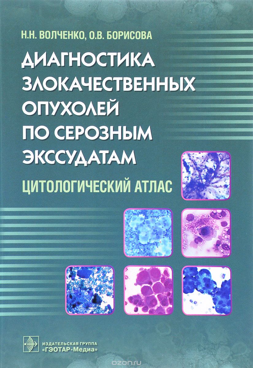 Скачать книгу "Диагностика злокачественных опухолей по серозным экссудатам., Н. Н. Волченко, О. В. Борисова"